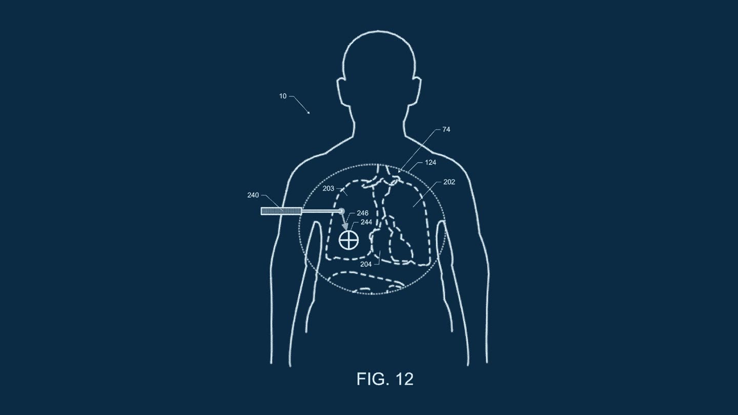 Patent drawing: an ultrasound probe being guided to a target on the torso